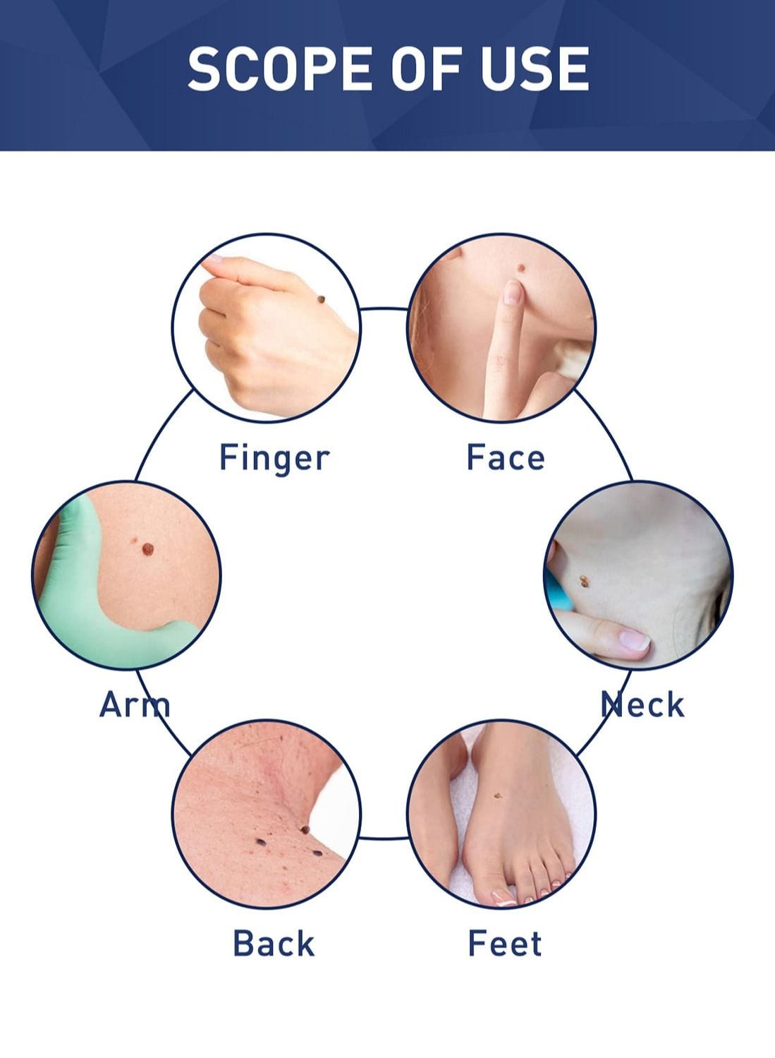 Herbal Skin Tag & Spot Corrector Liquid – Precision Care Serum Shop Herbal Skin Tag Treatment Serum For 1KD in Kuwait