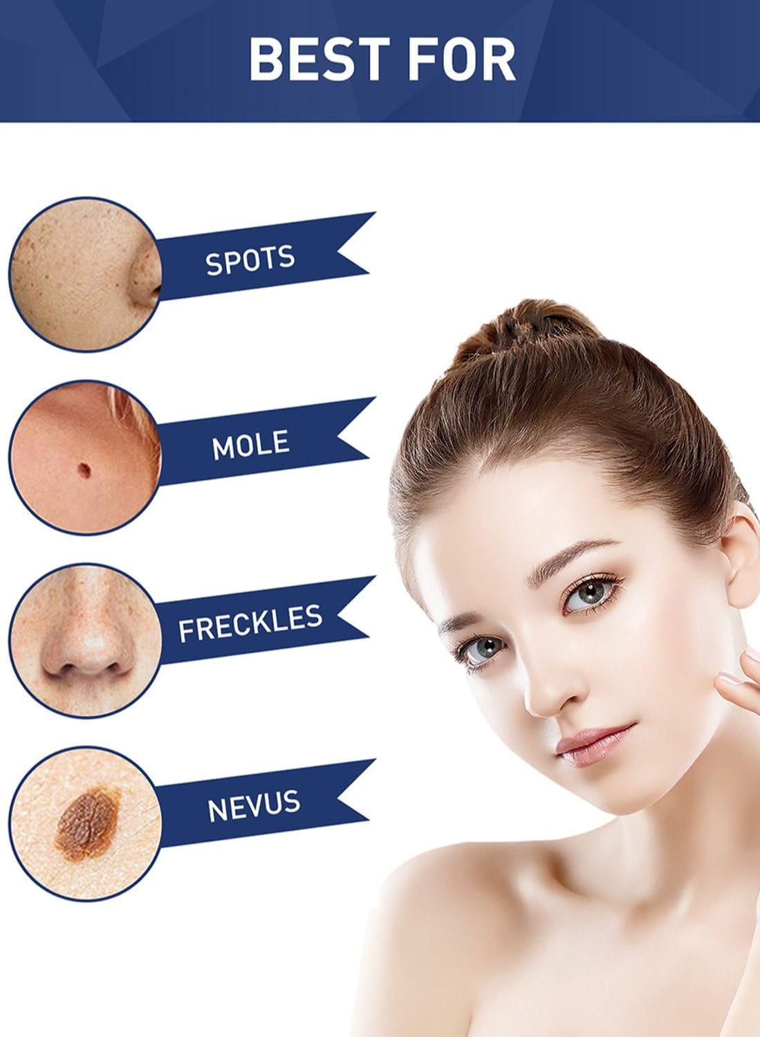 Herbal Skin Tag & Spot Corrector Liquid – Precision Care Serum Order Skin Tag Spot Corrector Liquid For 1KD in Kuwait