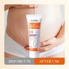 SADOER Oats Amino Acid Stretch Mark Repair Cream 40g Shop SADOER Stretch Mark Removal Cream For 1KD in Kuwait