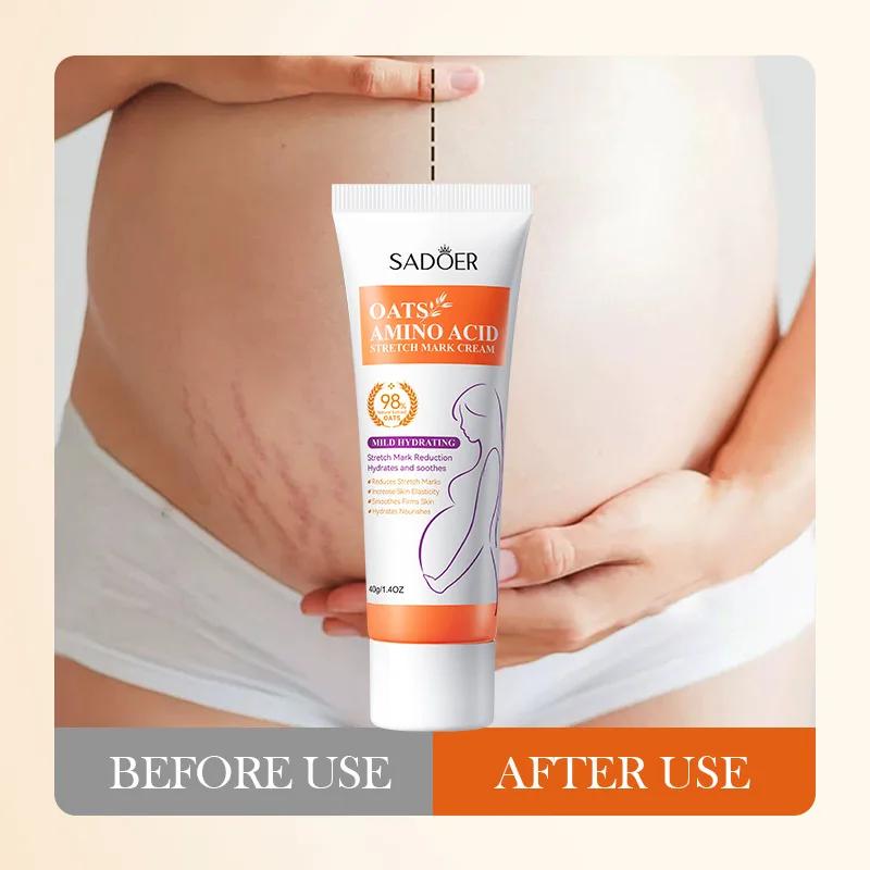 SADOER Oats Amino Acid Stretch Mark Repair Cream 40g Shop SADOER Stretch Mark Removal Cream For 1KD in Kuwait